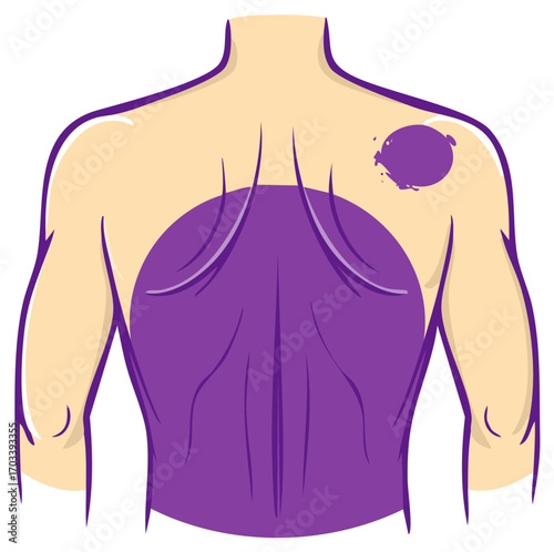 Anatomical vector illustration showing human back and shoulder pain areas for medical diagrams