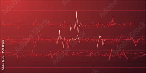 Electrocardiogram graph showing a heart's pulse rate on a monitor