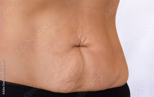 Fotografía Cropped female body with lower belly pooch and visible stretch marks
