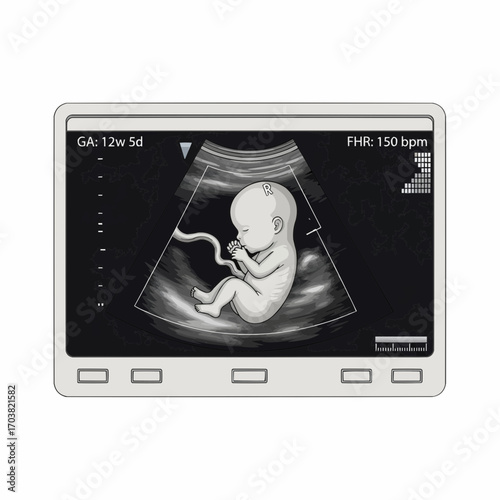 Ultrasound Image Displaying a Fetal Development in the First Trimester