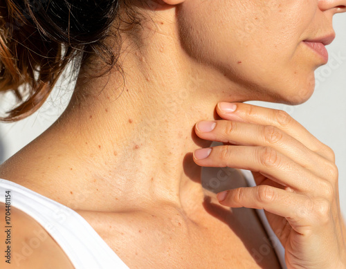 Woman's Neck and Chest with Moles, Hand Touching Skin, White Background