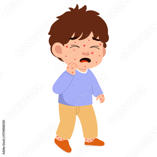 Illustration of Boy Suffering from Measles