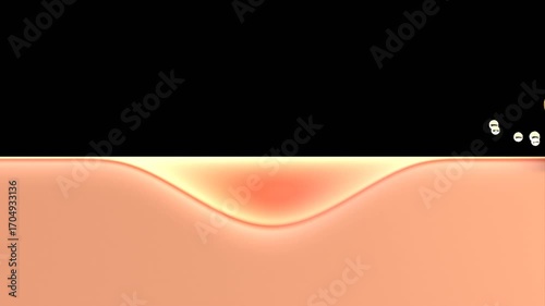 3D Animation of Acne cream drop and heal acne inflammatory to normal skin | Alpha Channel