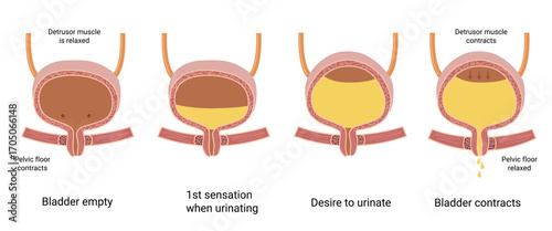 Human Bladder Anatomy. How The Bladder Works. Empty and full urinary bladder. The bladder muscles contract while the sphincter relaxes. Medical illustration
