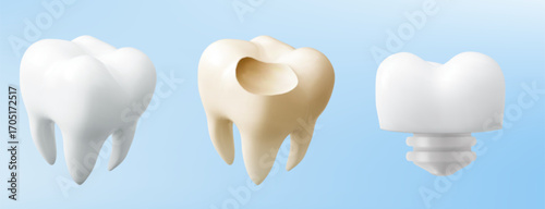 3D teeth icons set isolated on blue background. Vector realistic illustration of healthy white tooth, yellow caries hole and shiny denture mockups, dental hygiene and treatment, dentistry clinic