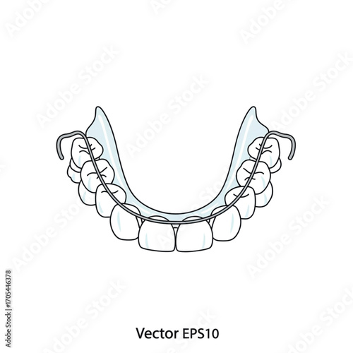 Dental Retainer For Teeth Alignment.