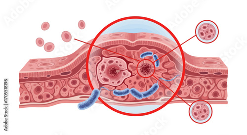 Medical illustration of skin layers with bacteria, perfect for science and healthcare use