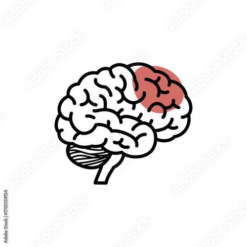 brain damage illustration a focal point of injury affecting the frontal lobeideal for illustrating neurological disorders research and patient education.