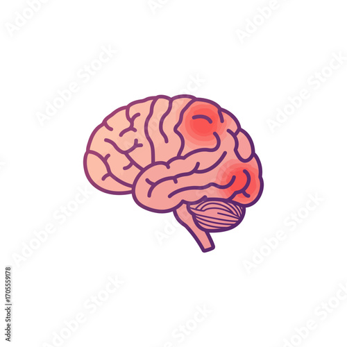 brain damage illustration showing inflammation on the brain highlighting health issues medical research and potential medical treatments.