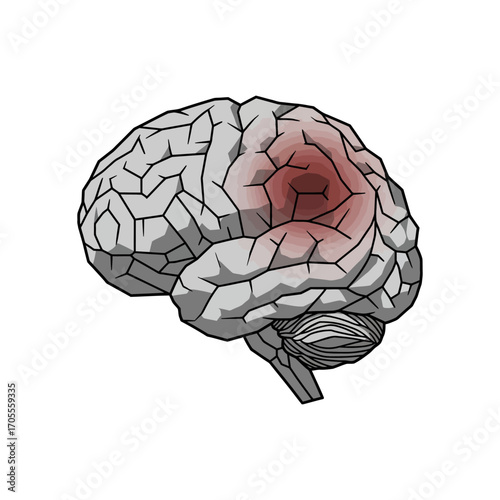 brain injury illustration highlighting trauma and damage to the cerebral cortex ideal for medical education and awareness campaigns.