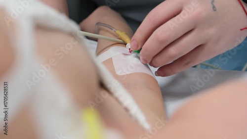 Medical professional carefully inserts and secures an intravenous catheter into a patient's arm, ensuring proper placement and hygiene in a clinical setting