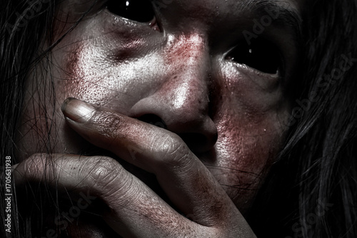 Wallpaper Mural Bloodied and Injured Face Covering Mouth with Hand – Horror and Fear Concept Torontodigital.ca