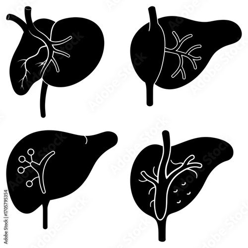 Illustrations showing different liver conditions and anatomical variations in black and white style