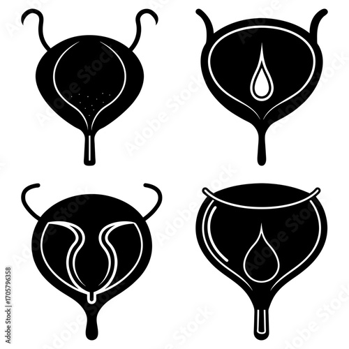 Four bladder illustrations displaying varying degrees of fullness and internal structures shown in black and white