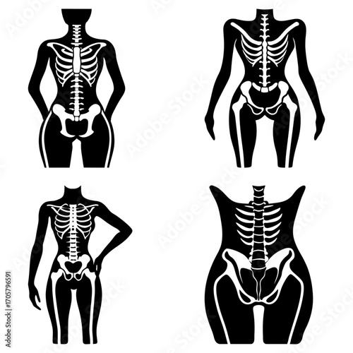 Four black anatomical illustrations of female skeletons with varying body types on a white background
