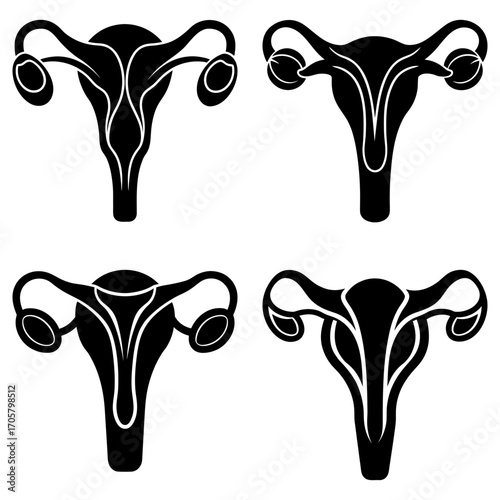 Four uterus illustrations in black and white showing female reproductive system anatomy and health diagram