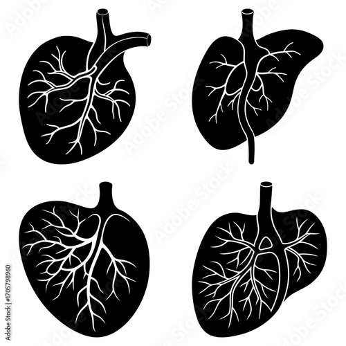 Four anatomical heart and lung illustrations in black and white showing vascular structures clearly displayed