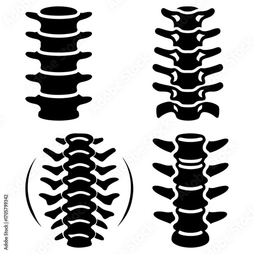 Illustration showing four different spinal column depictions in black and white anatomical representations