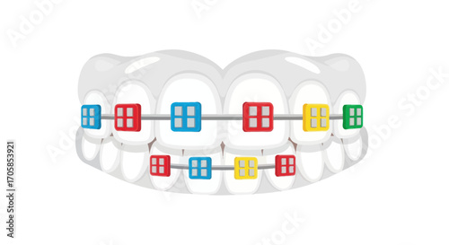 Teeth with Colorful Braces: Orthodontic Treatment Illustration.