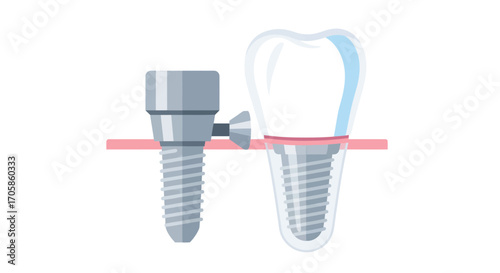 Dental Implant Screw and Natural Tooth Diagram for Oral Health.