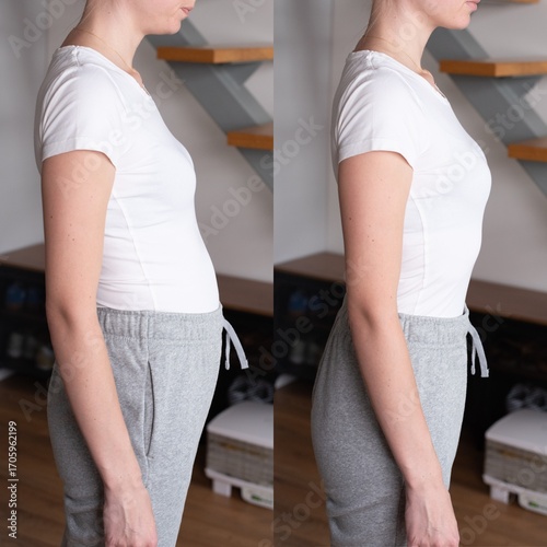 Before and after comparison showing bloated belly and flat stomach in a woman. Concept of digestion, diet, wellness, gut health, healthy habits, and lifestyle improvement.