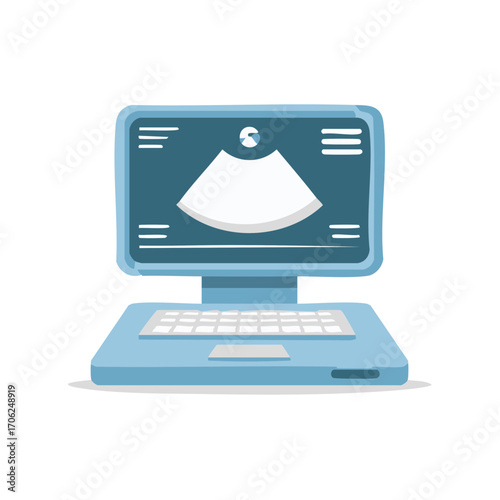 Laptop computer displaying medical ultrasound scan for diagnostic imaging