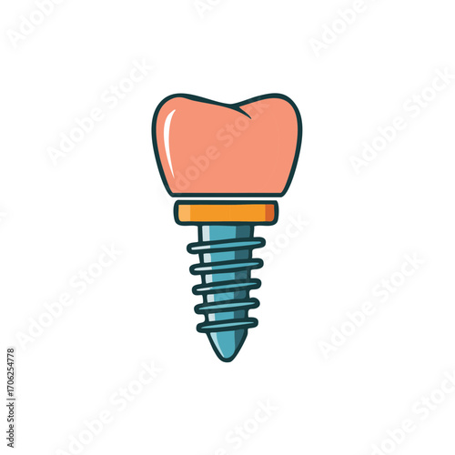 Illustrated Dental Implant with Tooth Crown
