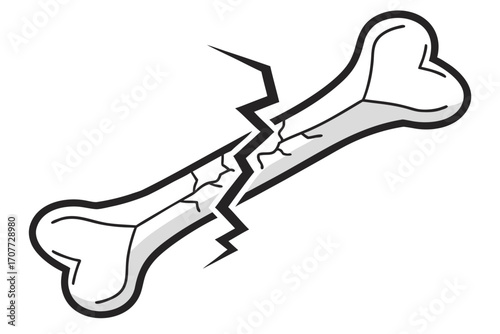 Broken Bone Illustration with Cracks.