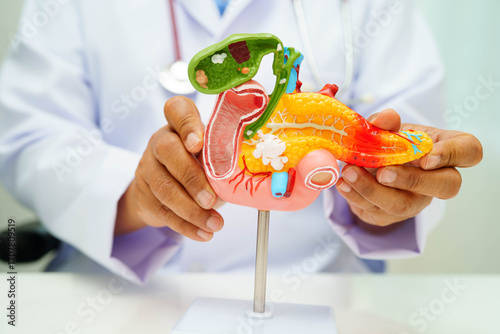 Pancreatitis, pancreatic cancer, Asian doctor with pancreas, gallbladder and bile duct human anatomy model at hospital.
