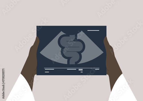 Hands hold an ultrasound image displaying a digestive system, emphasizing the role of ultrasound in medical diagnoses and patient care information in healthcare settings.
