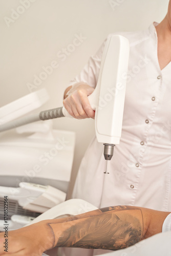 Caucasian female adult dermatologist performing laser tattoo removal on patient s arm in clinic setting.