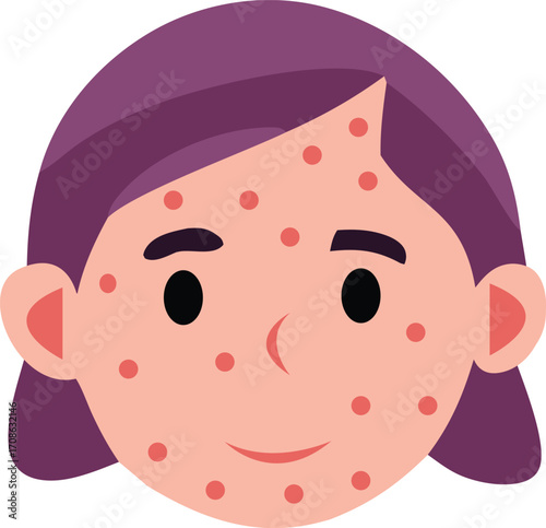 Portrait of the pimple girl on transparent background