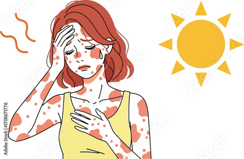 Woman suffering from sunburn and heat rash on a hot sunny day