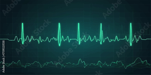 Electrocardiogram (ECG) showing a green heartbeat wave on a hospital monitor, illustrating the pulse rate and cardiac health