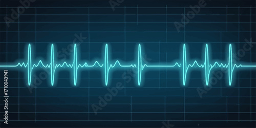EKG heart beat on a monitor screen illustrating a blue medical cardiology wave and pulse rate chart