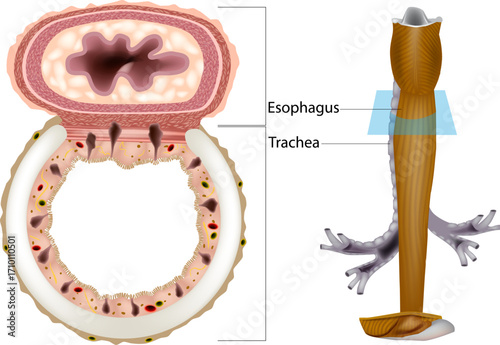 Detailed medical illustration showing the anatomy of the human trachea and esophagus. The image includes a cross-sectional view with histological details of the tracheal wall and surrounding structure