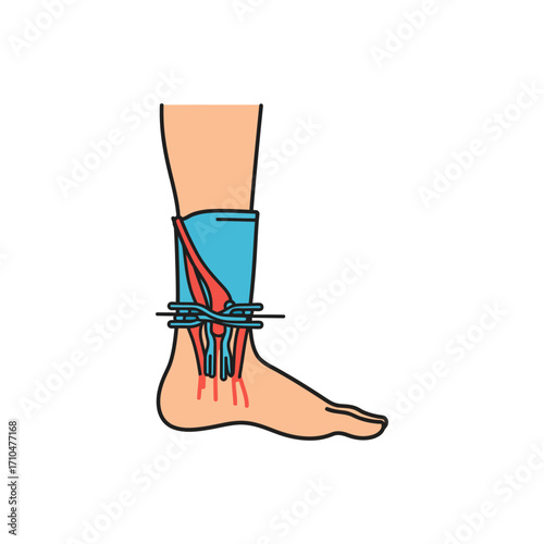 ankle sprain illustration showing injury foot support and treatment perfect for health content and injury recovery guides
