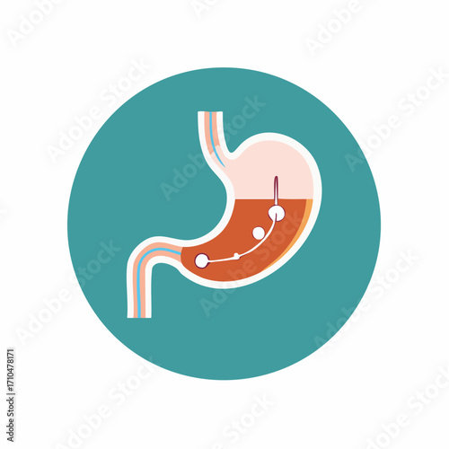 Human stomach anatomy cross section showing a gastric balloon procedure vector illustration