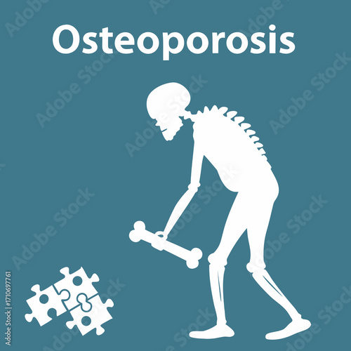 Elderly skeleton struggles with bone health, puzzle pieces signify challenges of osteoporosis and aging