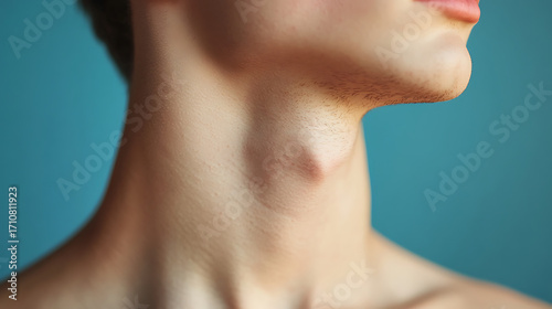 Close up of young man neck showing visible swelling or lump, with smooth skin and neutral background, highlighting neck area and skin texture