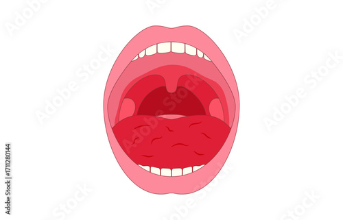 Xerostomia or dry mouth