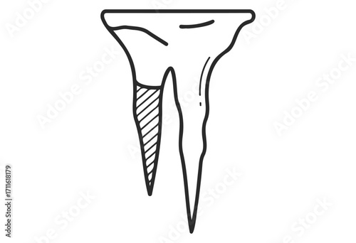 Black and white tooth diagram with exposed root cross section - stock vector