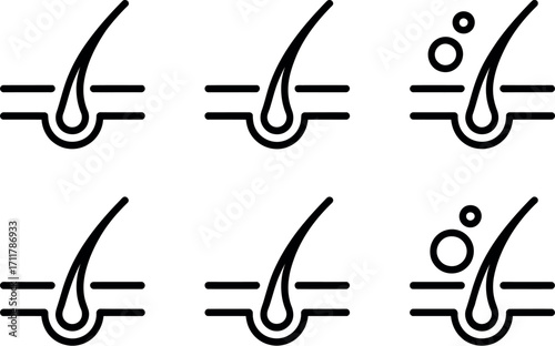 Illustrations depicting hair follicle health and follicle treatment with bubbles