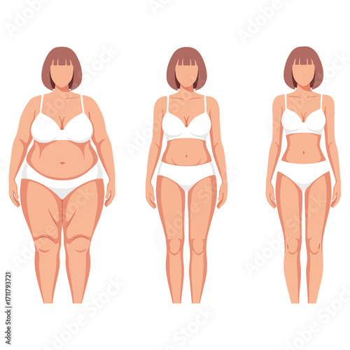 Body transformation stages of a woman in underwear.