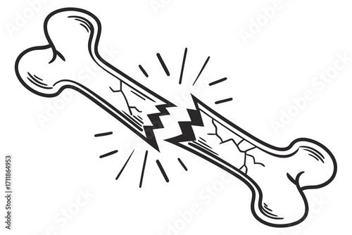 Broken Bone Illustration with Cracks and Rays.