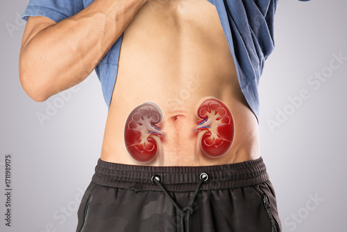 Image shows lower back kidney pain, a common symptom of chronic kidney disease or acute renal failure. Early diagnosis and nephrology care can help slow disease progression.
