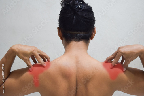 shoulder-scapular periarthritis, shoulder blades pain, joint inflammation, man backache at home