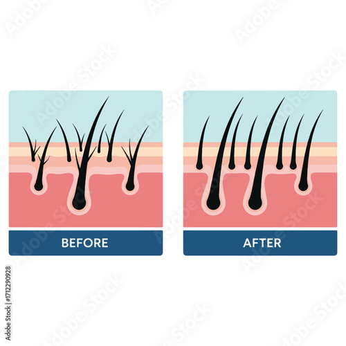 Hair Growth Treatment - Before and After Comparison.