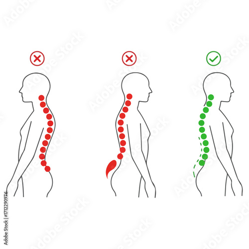 Human posture illustration showing correct and incorrect spinal alignment.