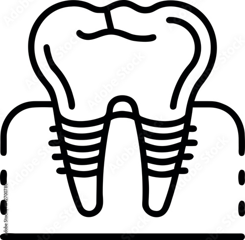 Vector art of dental implant icon with tooth illustration design